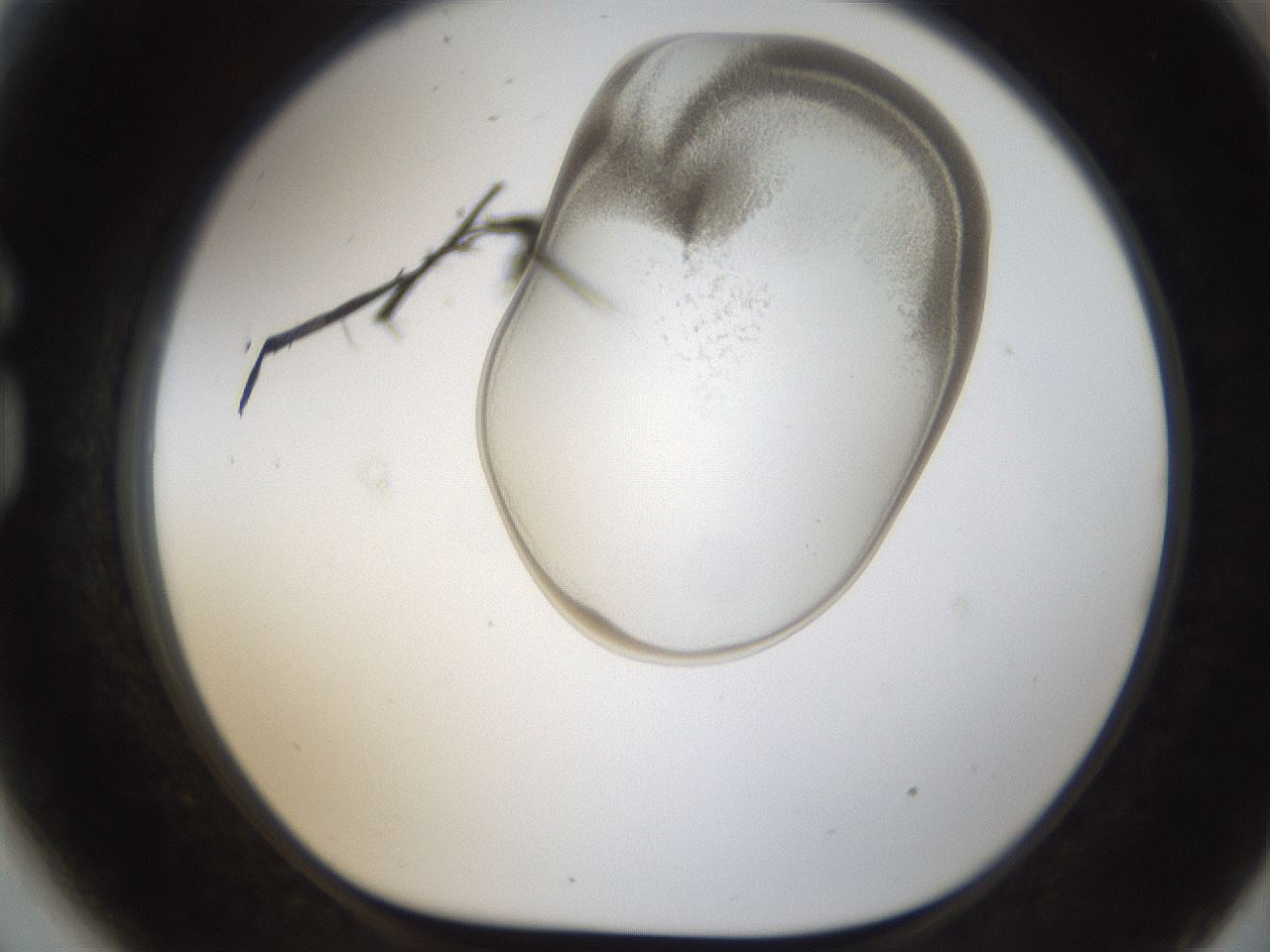 folderID157_plateID1157_batchID3210_wellNum81_profileID1_d1_r63551_ef.jpg