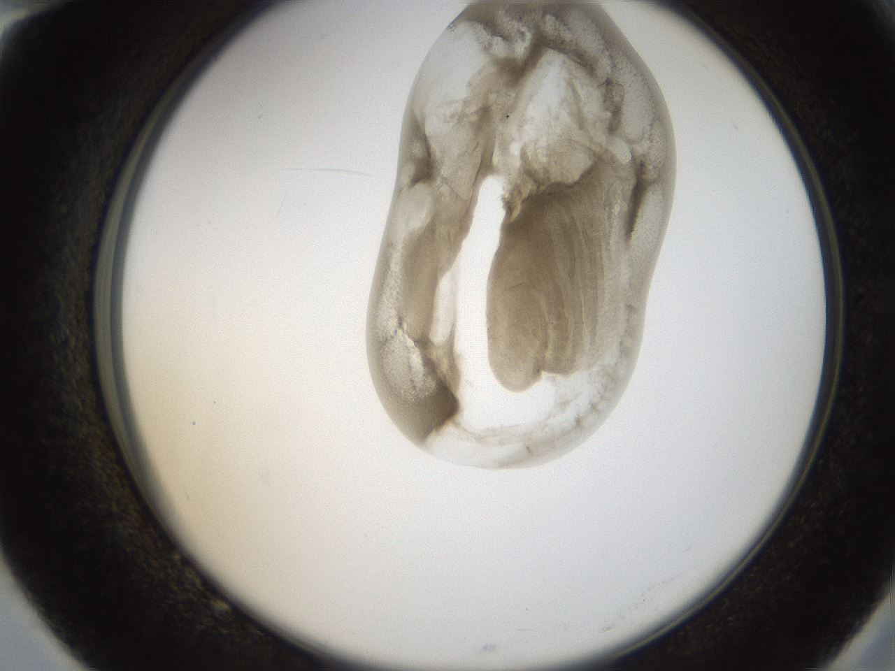 folderID157_plateID1157_batchID3210_wellNum82_profileID1_d2_r63554_ef.jpg