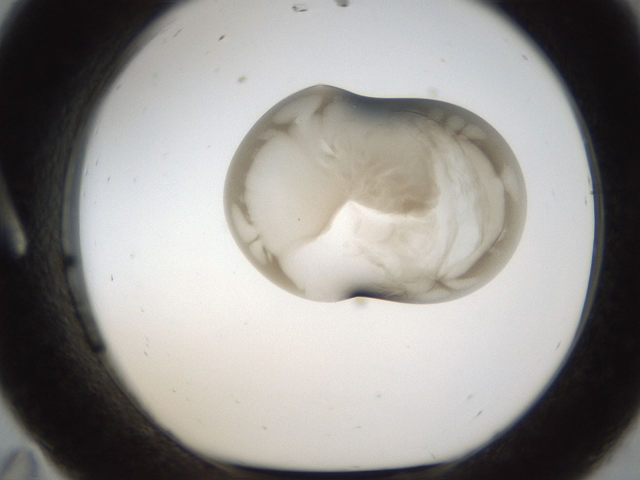 folderID158_plateID1158_batchID3207_wellNum11_profileID1_d1_r62835_ef.jpg