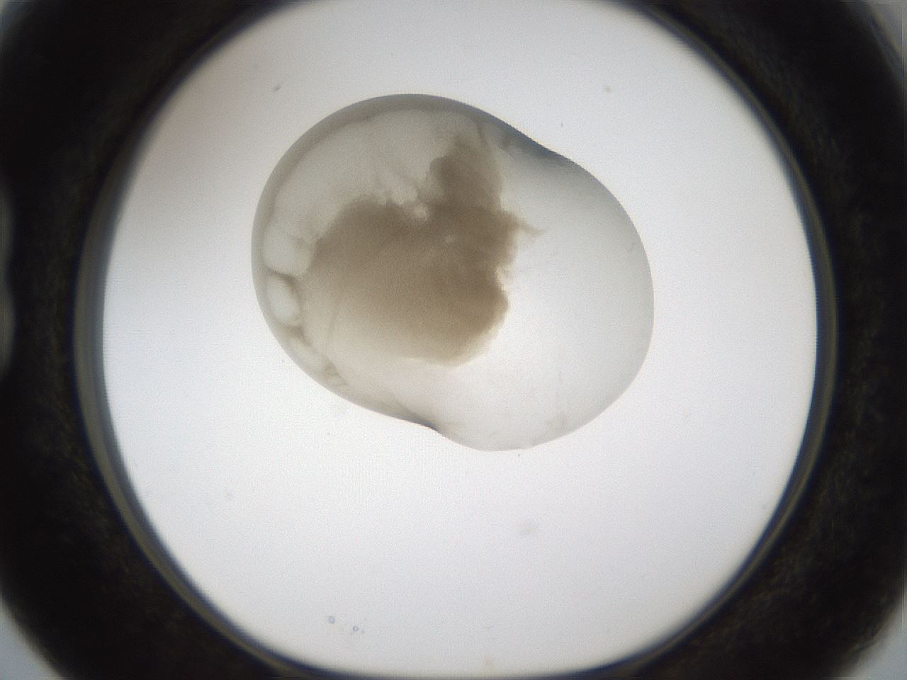 folderID158_plateID1158_batchID3207_wellNum15_profileID1_d1_r62843_ef.jpg