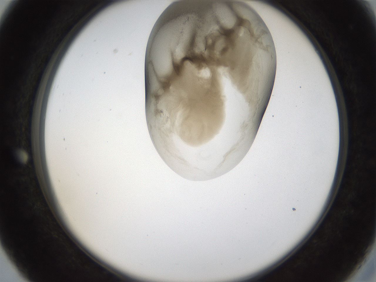 folderID157_plateID1157_batchID3210_wellNum27_profileID1_d2_r63444_ef.jpg