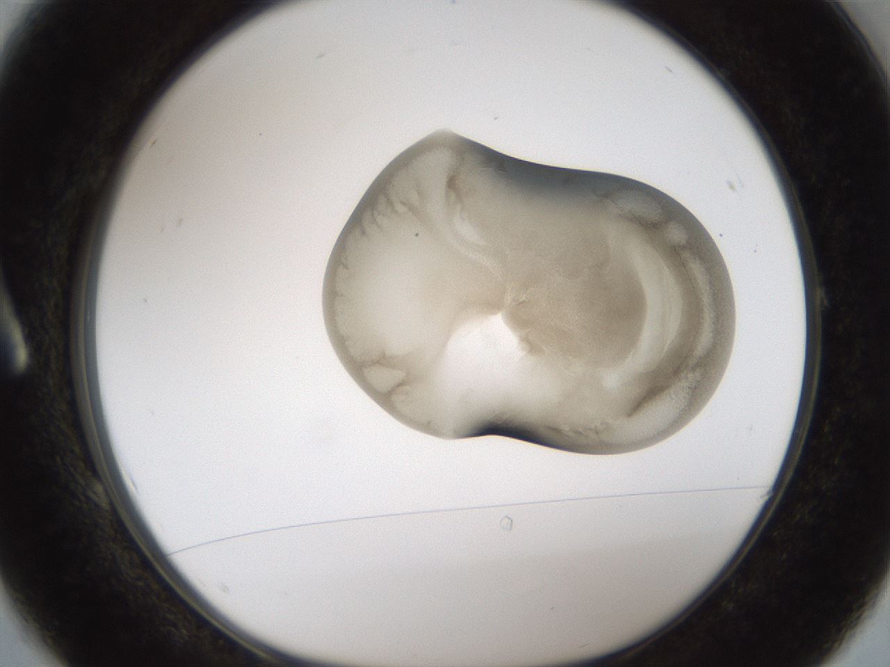 folderID158_plateID1158_batchID3207_wellNum1_profileID1_d1_r62815_ef.jpg