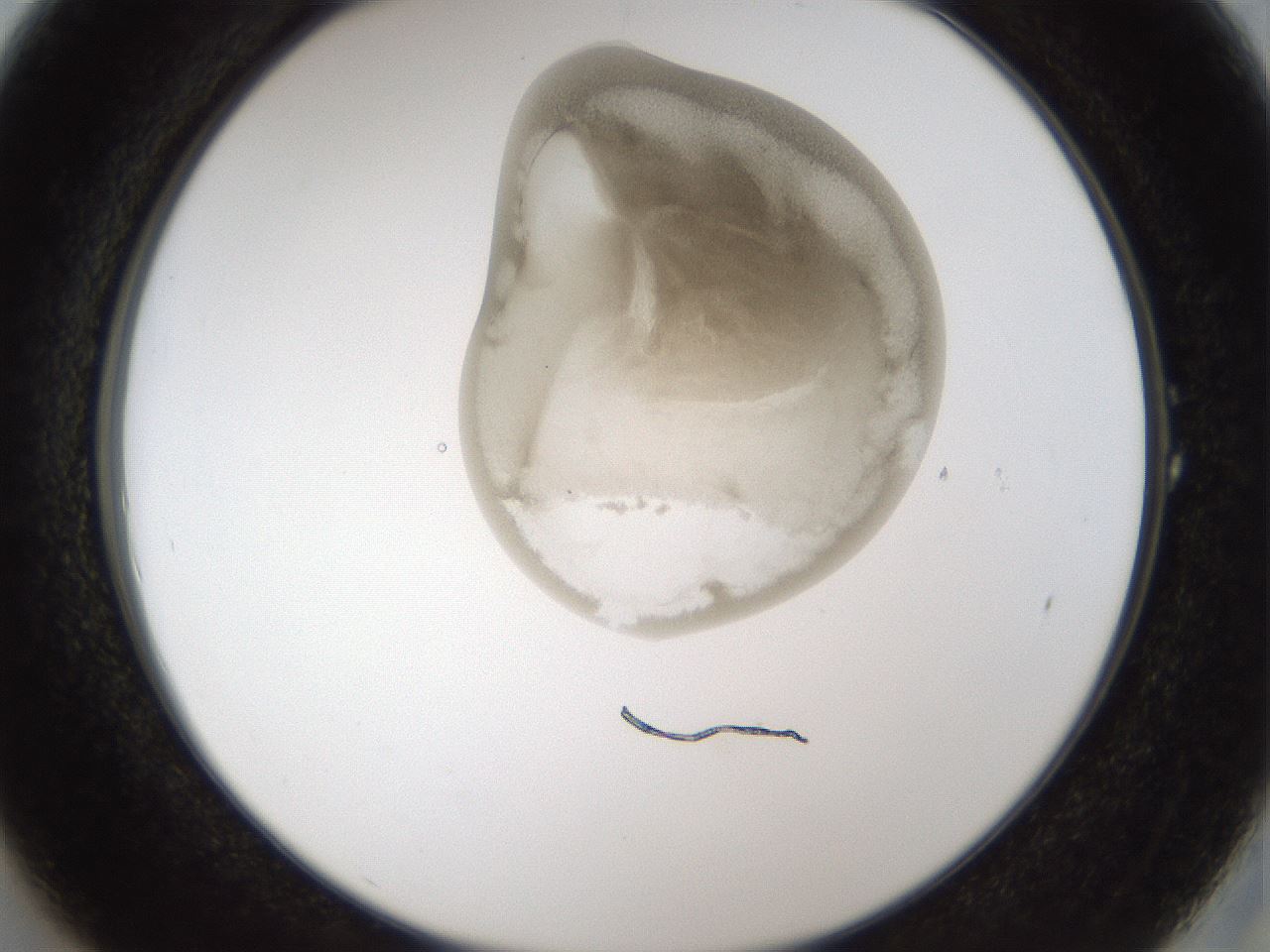 folderID158_plateID1158_batchID3207_wellNum1_profileID1_d2_r62816_ef.jpg