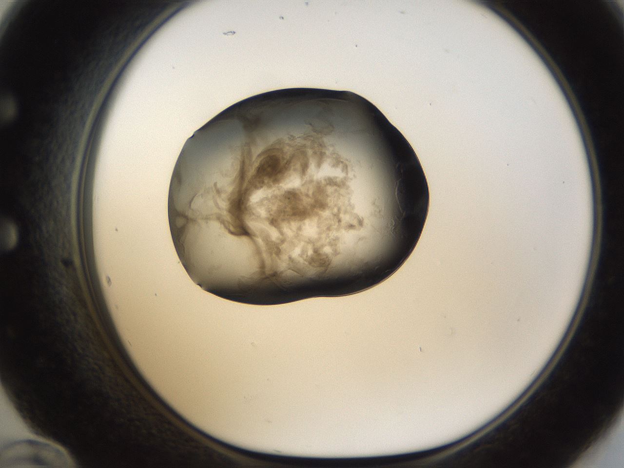 folderID158_plateID1158_batchID3207_wellNum60_profileID1_d1_r62933_ef.jpg