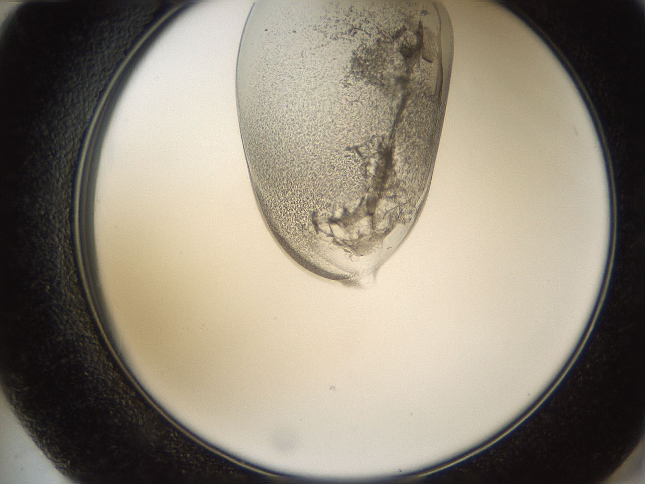 folderID158_plateID1158_batchID3207_wellNum72_profileID1_d2_r62958_ef.jpg