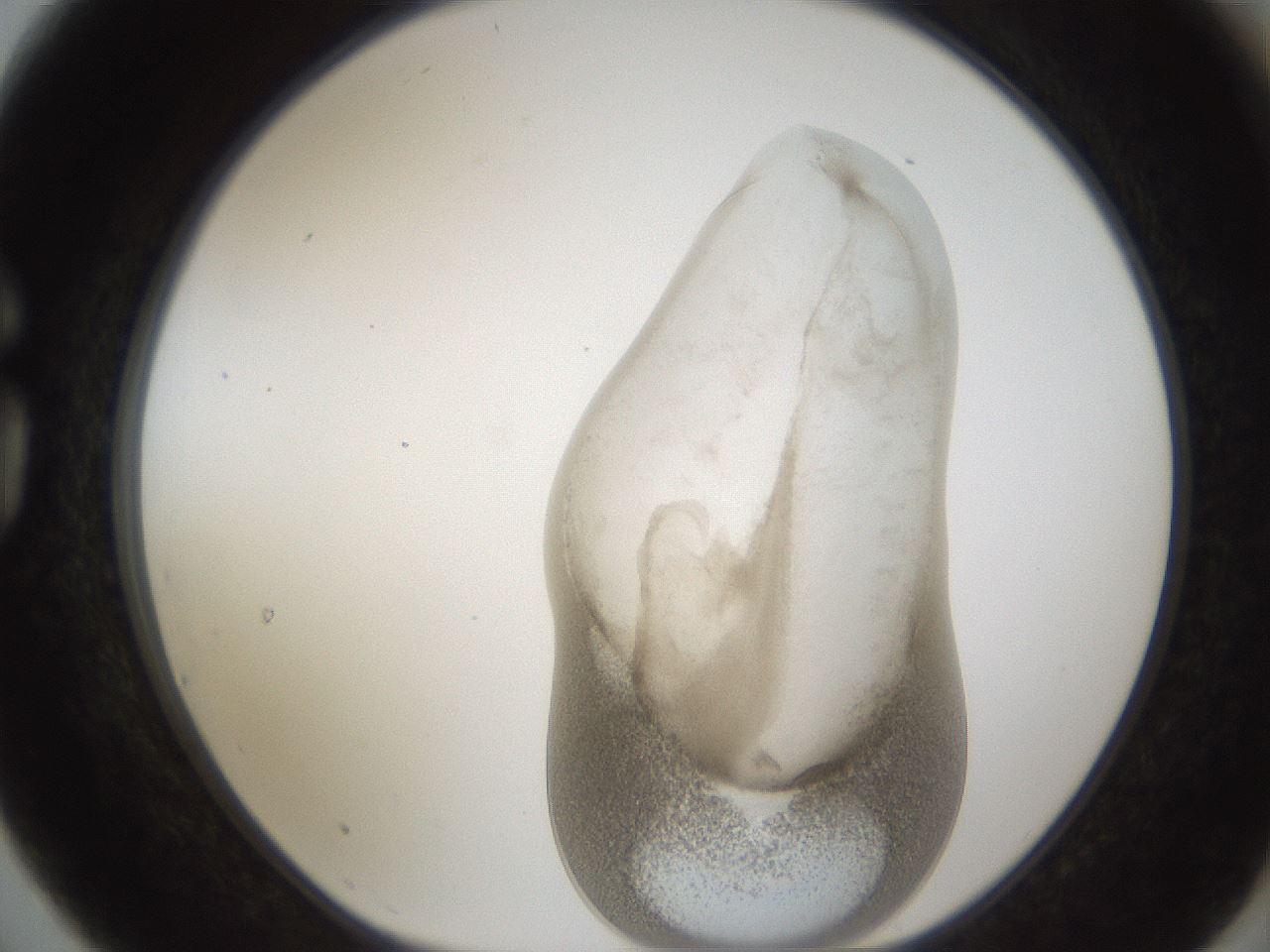 folderID158_plateID1158_batchID3207_wellNum75_profileID1_d1_r62963_ef.jpg