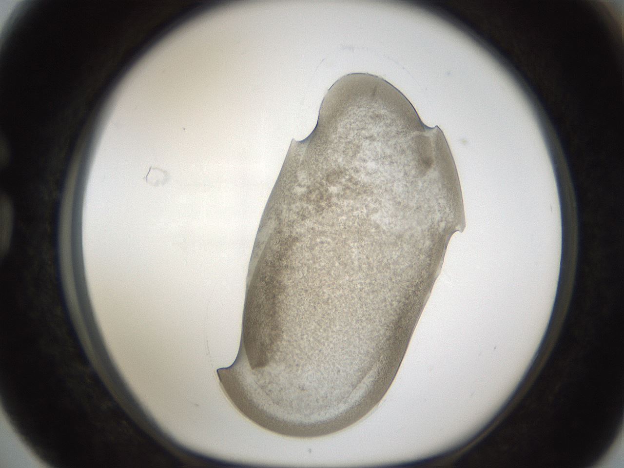 folderID158_plateID1158_batchID3207_wellNum76_profileID1_d1_r62965_ef.jpg