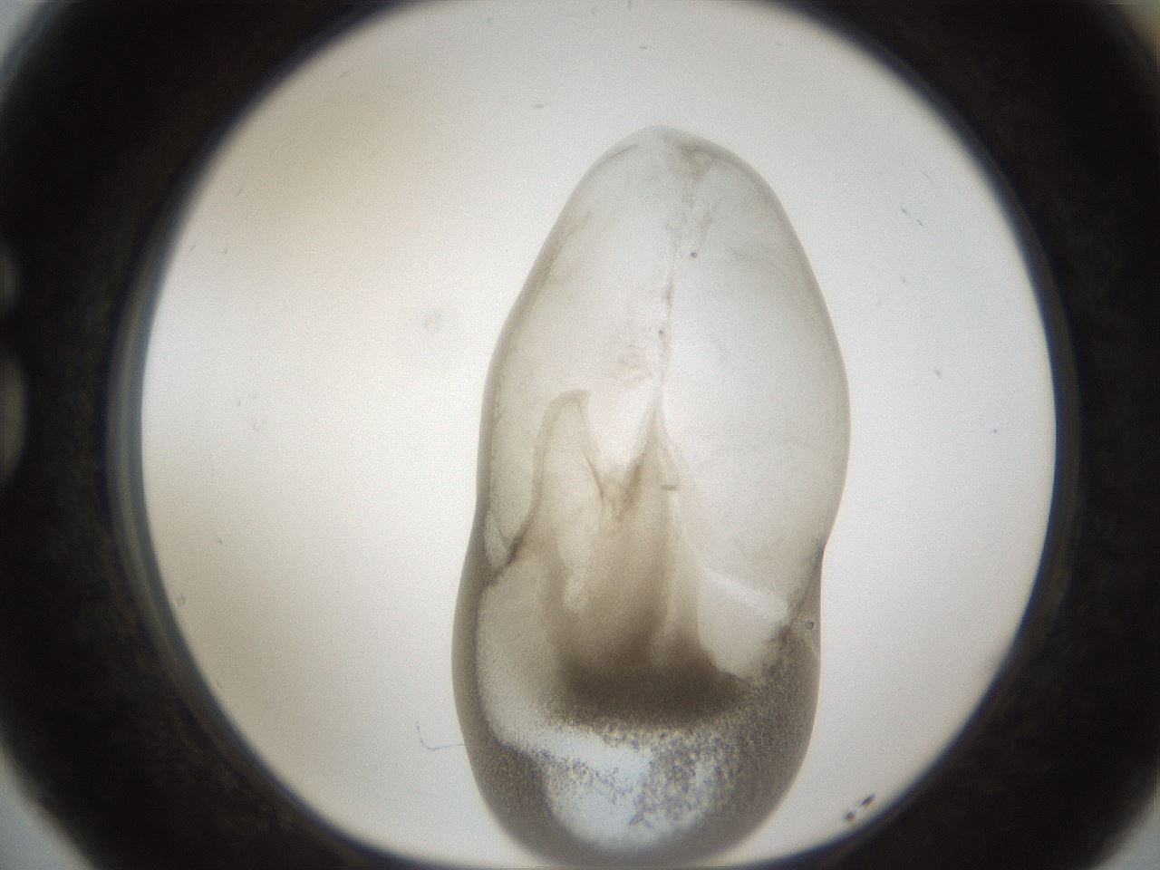 folderID158_plateID1158_batchID3207_wellNum77_profileID1_d1_r62967_ef.jpg