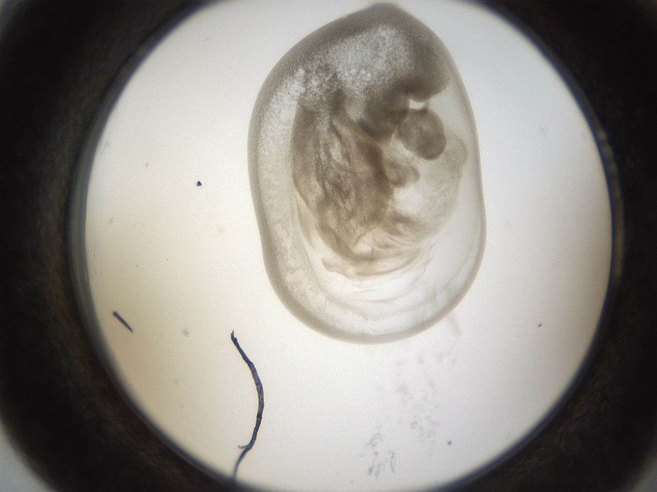 folderID158_plateID1158_batchID3207_wellNum79_profileID1_d2_r62972_ef.jpg