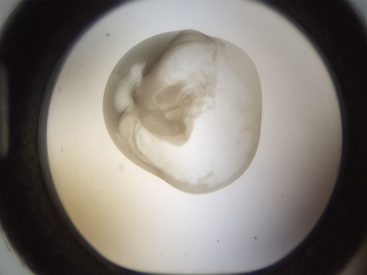folderID158_plateID1158_batchID3207_wellNum93_profileID1_d1_r62999_ef.jpg