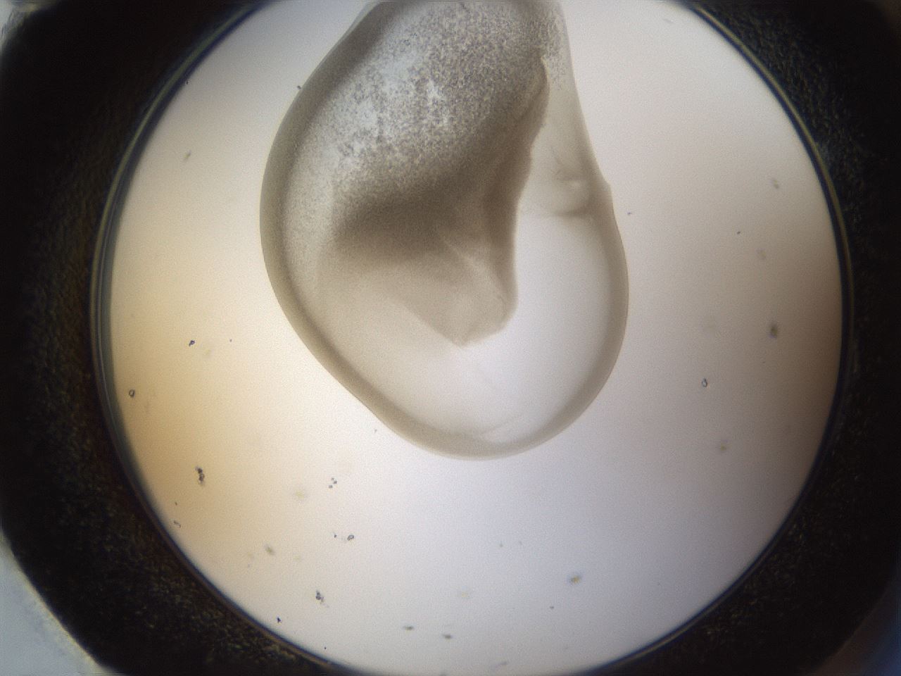folderID158_plateID1158_batchID3207_wellNum95_profileID1_d2_r63004_ef.jpg