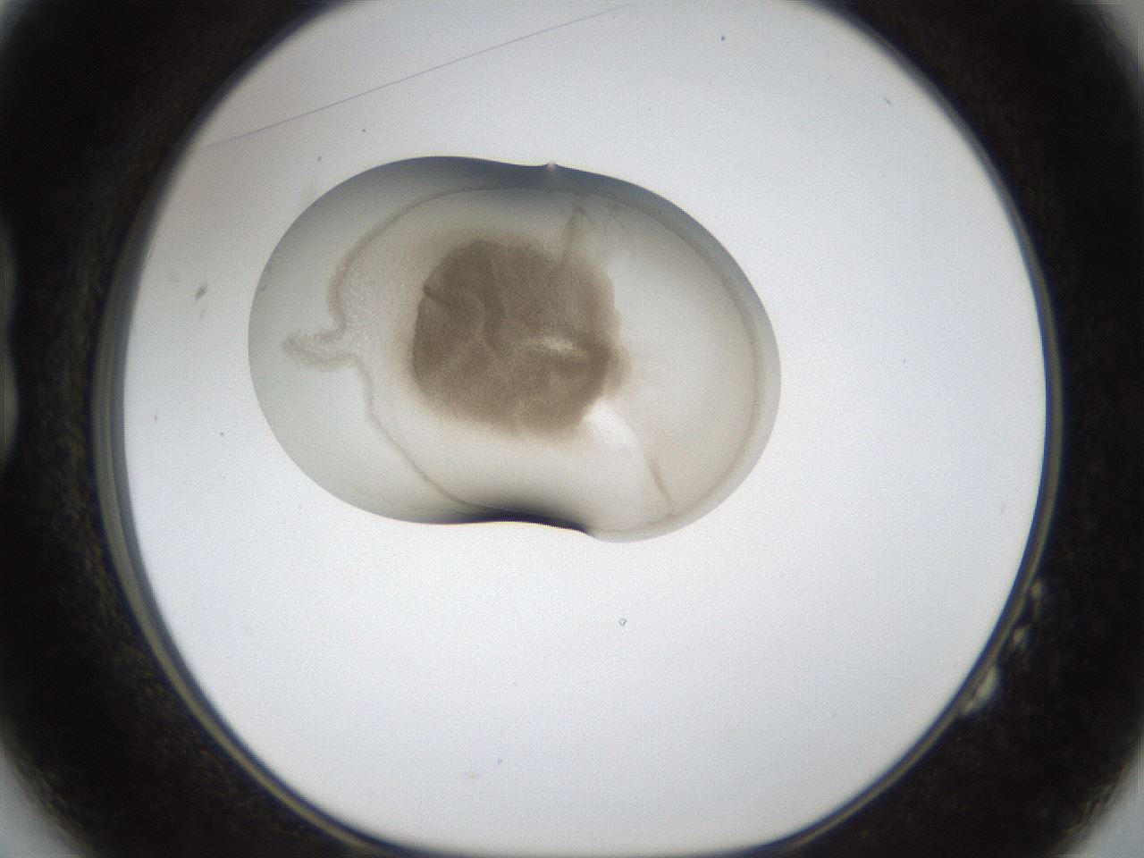 folderID159_plateID1159_batchID3197_wellNum14_profileID1_d1_r61881_ef.jpg