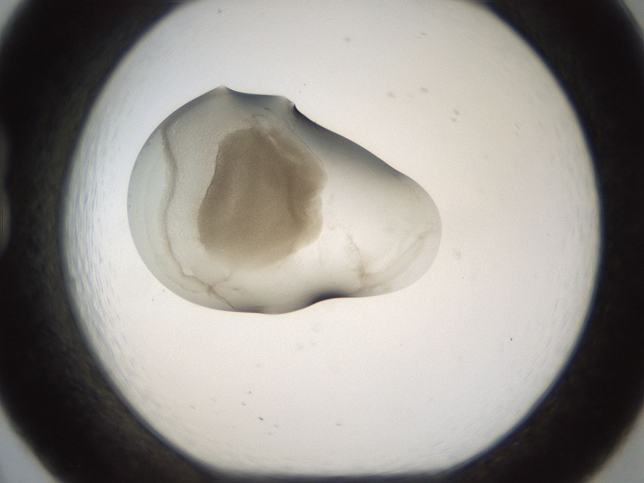 folderID159_plateID1159_batchID3197_wellNum20_profileID1_d1_r61893_ef.jpg