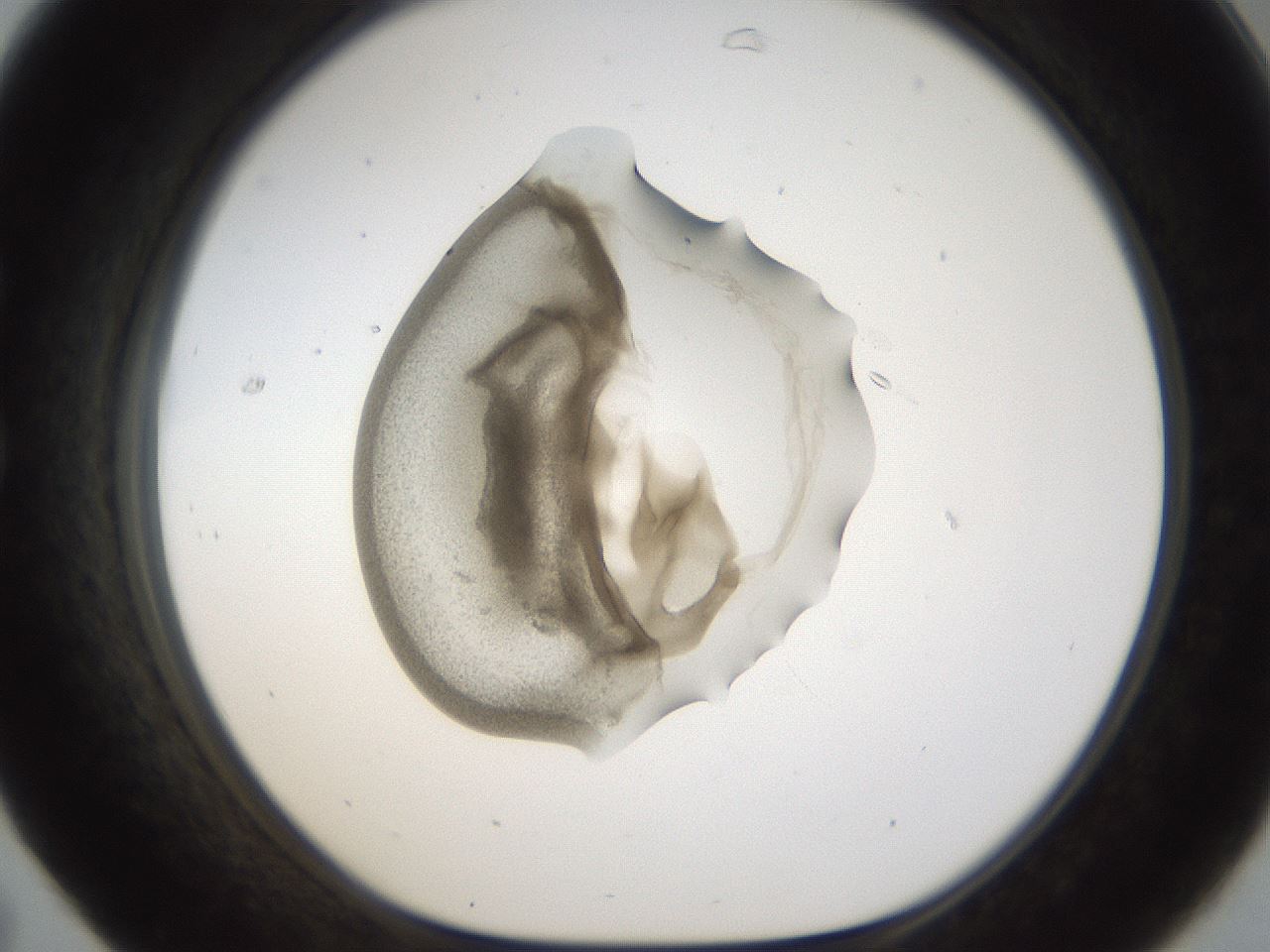 folderID159_plateID1159_batchID3197_wellNum31_profileID1_d1_r61915_ef.jpg