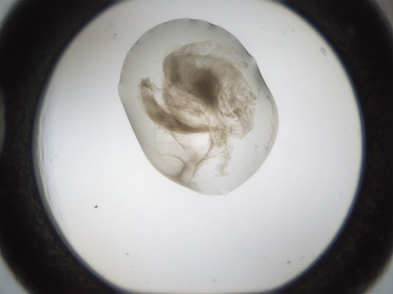 folderID159_plateID1159_batchID3197_wellNum39_profileID1_d1_r61931_ef.jpg