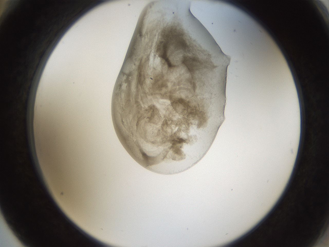 folderID159_plateID1159_batchID3197_wellNum76_profileID1_d2_r62006_ef.jpg