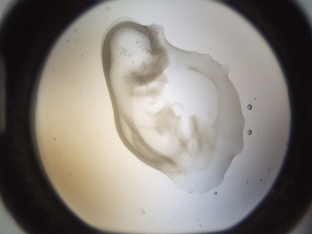 folderID159_plateID1159_batchID3197_wellNum92_profileID1_d1_r62037_ef.jpg