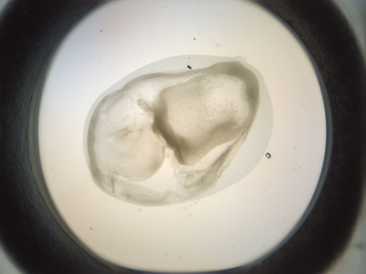 folderID15_plateID1015_batchID1886_wellNum33_profileID1_d1_r43012_ef.jpg