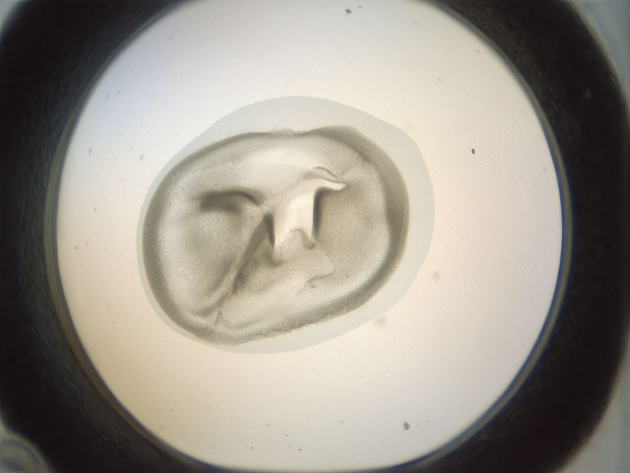 folderID15_plateID1015_batchID1886_wellNum34_profileID1_d1_r43013_ef.jpg