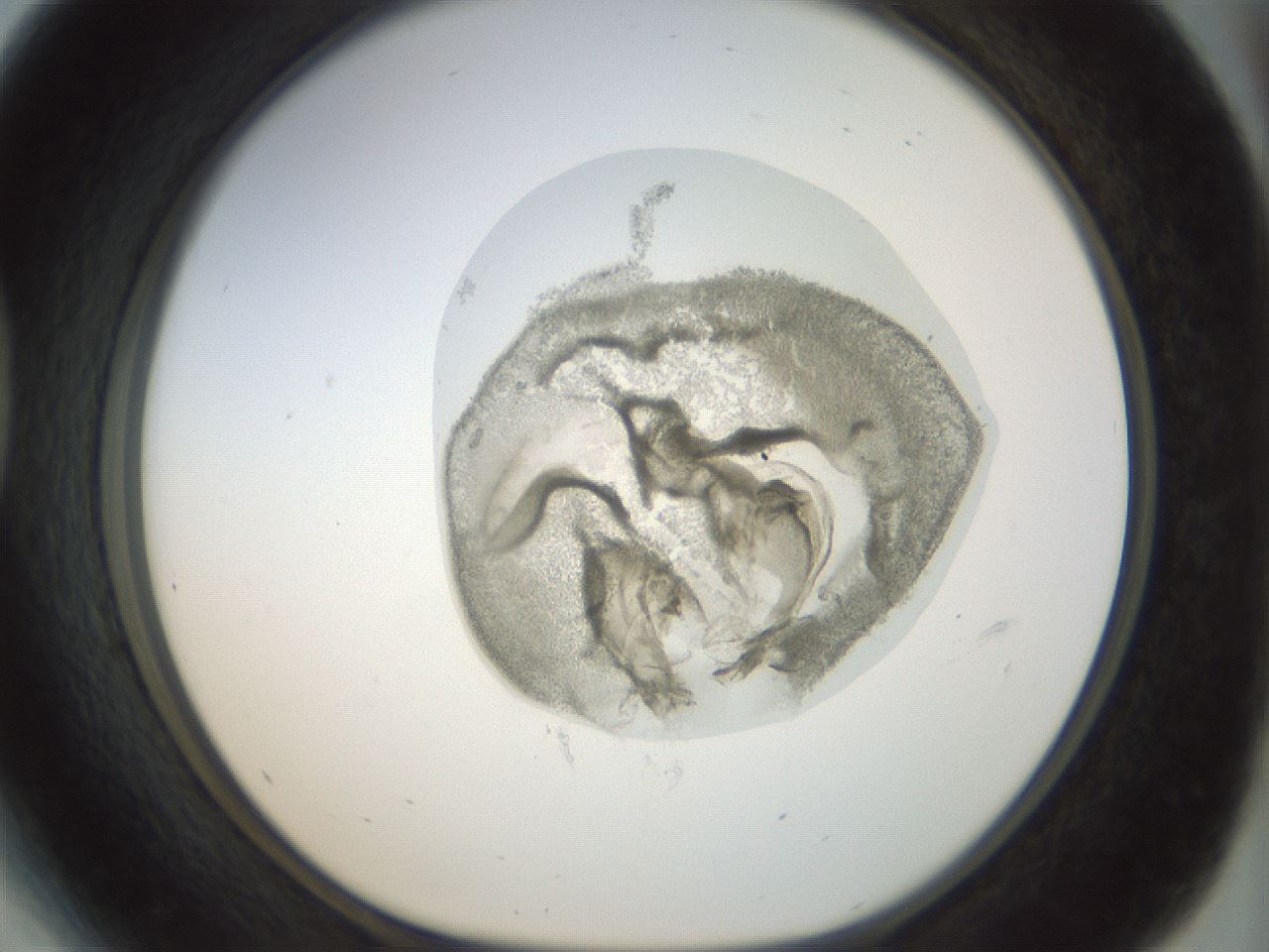 folderID15_plateID1015_batchID1886_wellNum41_profileID1_d1_r43020_ef.jpg
