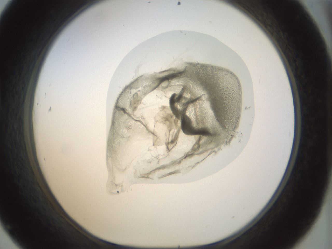 folderID15_plateID1015_batchID1886_wellNum45_profileID1_d1_r43024_ef.jpg