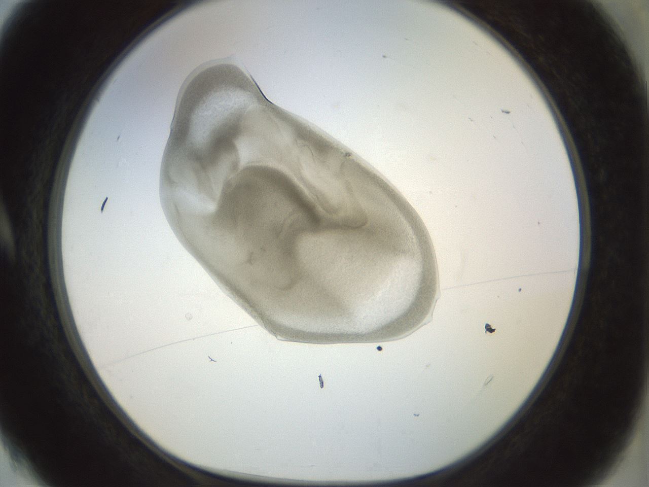 folderID15_plateID1015_batchID1886_wellNum4_profileID1_d1_r42983_ef.jpg