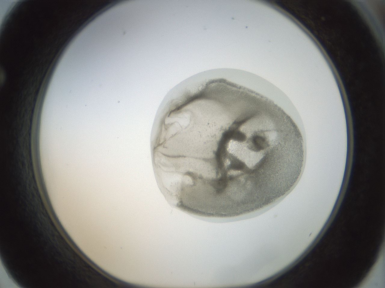 folderID15_plateID1015_batchID1886_wellNum62_profileID1_d1_r43041_ef.jpg