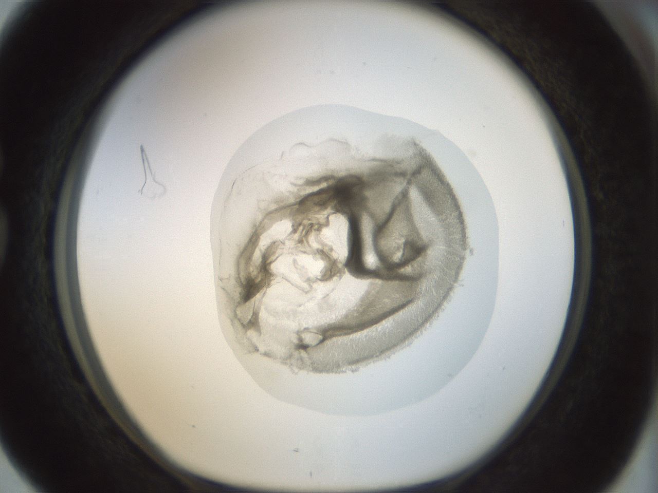 folderID15_plateID1015_batchID1886_wellNum76_profileID1_d1_r43055_ef.jpg
