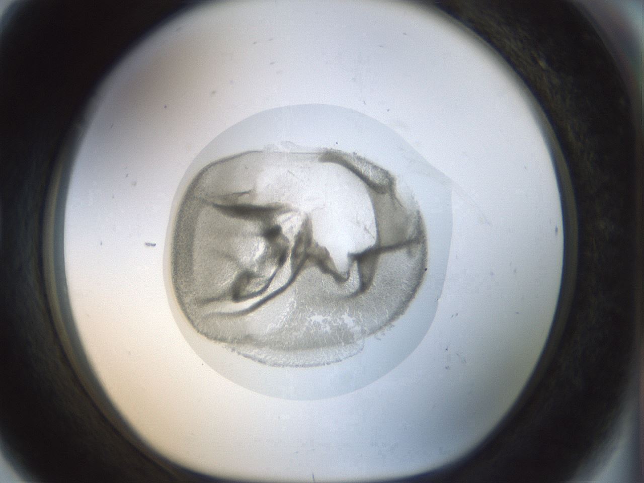 folderID15_plateID1015_batchID1886_wellNum80_profileID1_d1_r43059_ef.jpg