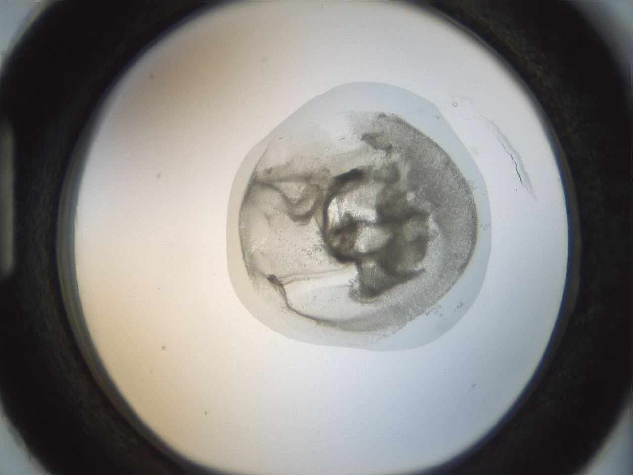 folderID15_plateID1015_batchID1886_wellNum87_profileID1_d1_r43066_ef.jpg