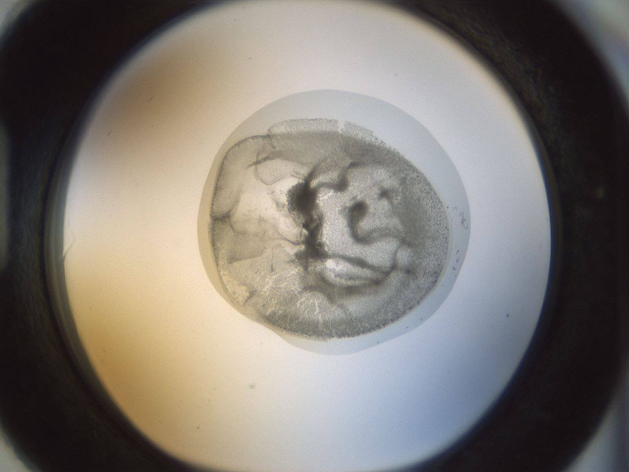 folderID15_plateID1015_batchID1886_wellNum90_profileID1_d1_r43069_ef.jpg
