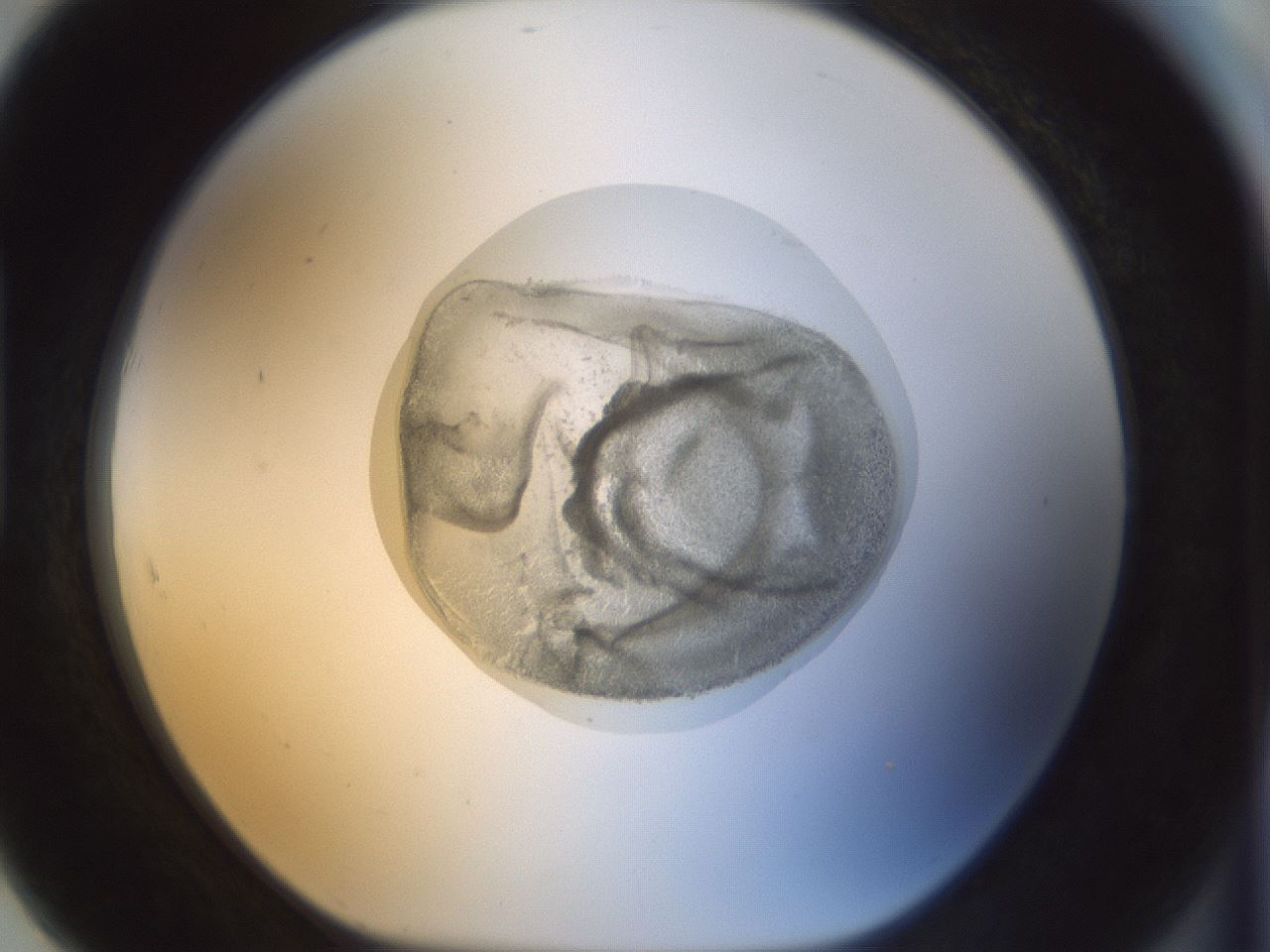 folderID15_plateID1015_batchID1886_wellNum91_profileID1_d1_r43070_ef.jpg