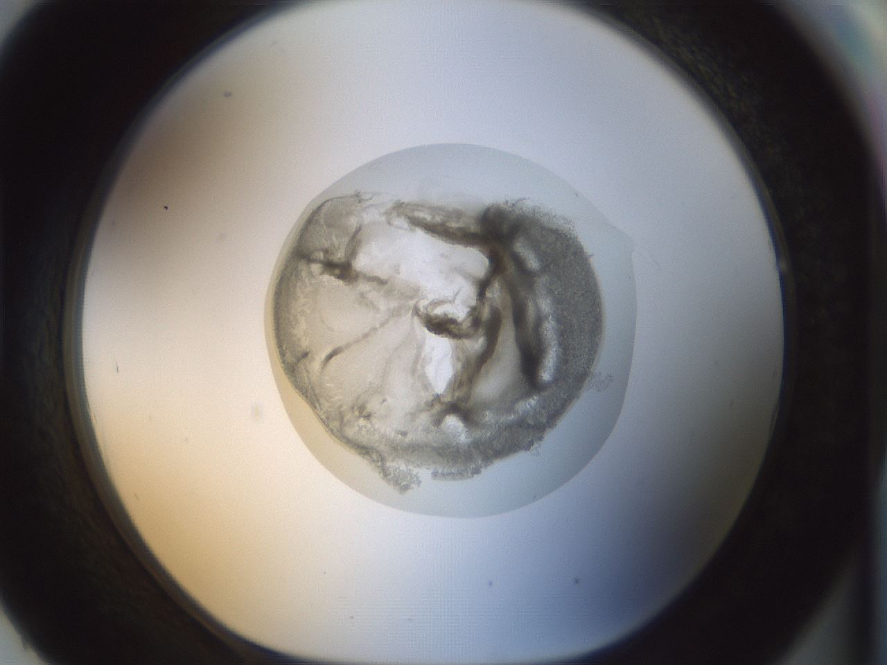 folderID15_plateID1015_batchID1886_wellNum93_profileID1_d1_r43072_ef.jpg