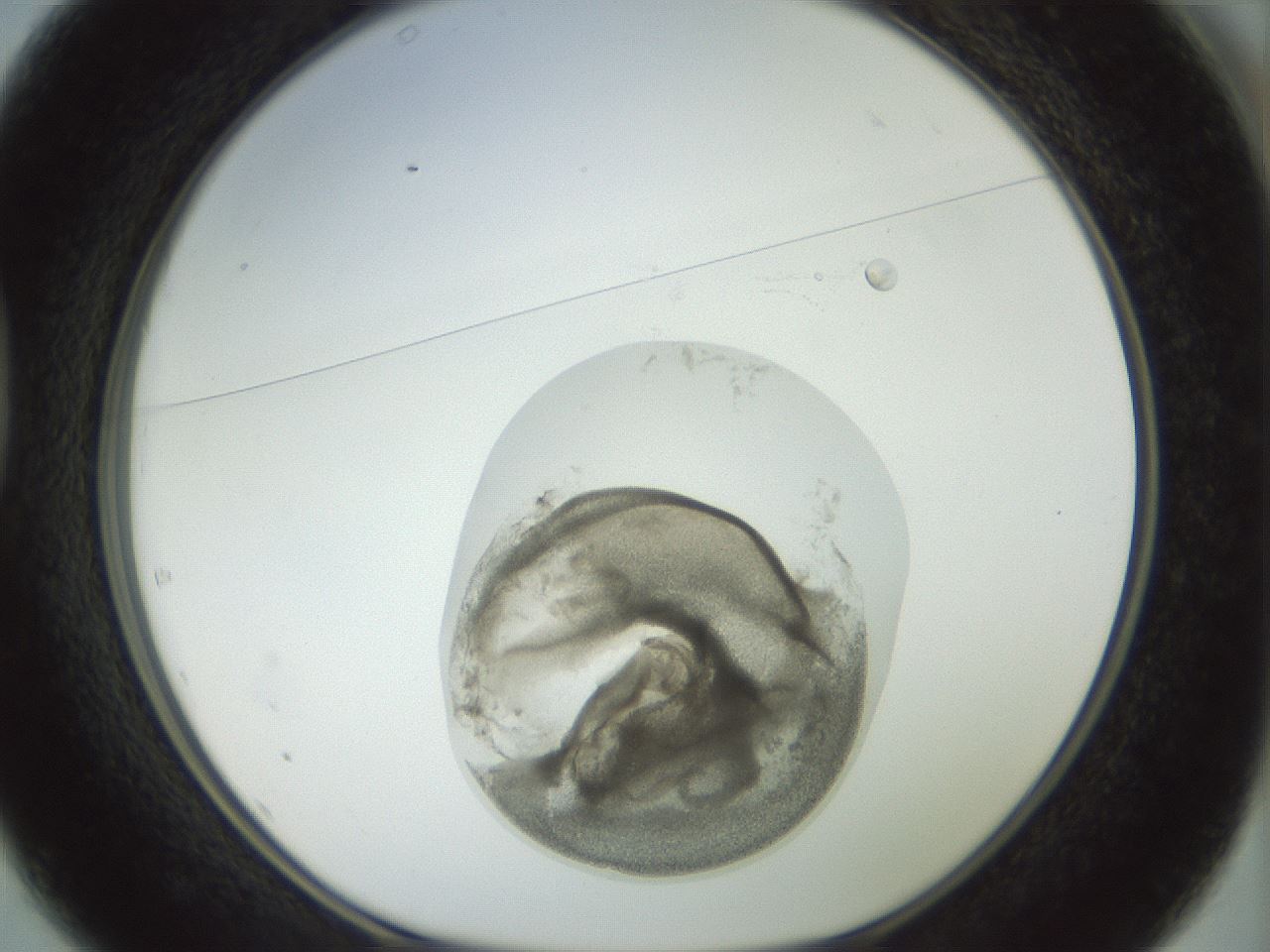 folderID15_plateID1015_batchID1886_wellNum37_profileID1_d1_r43016_ef.jpg