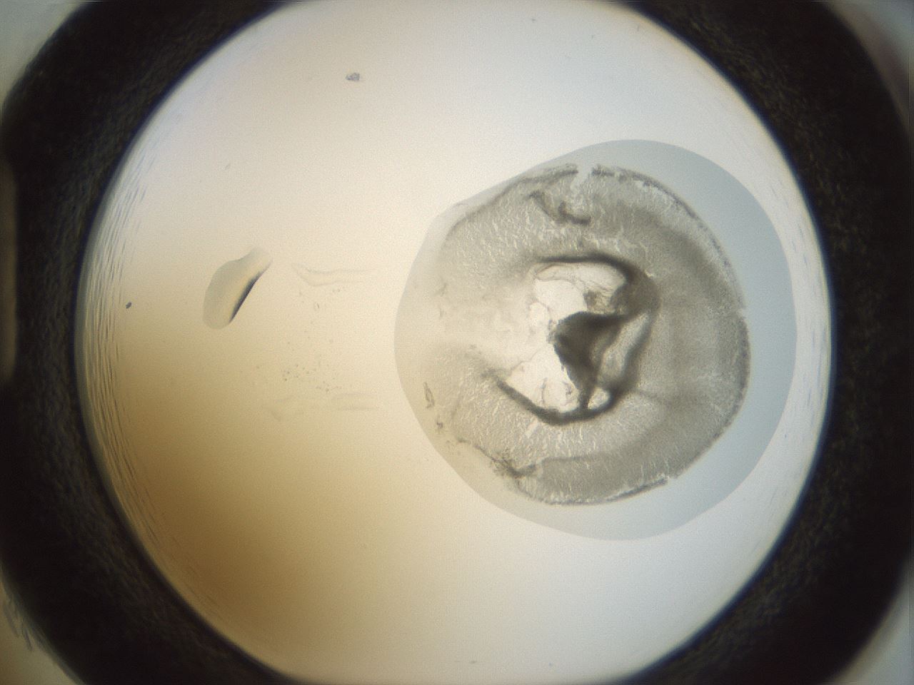 folderID15_plateID1015_batchID1886_wellNum85_profileID1_d1_r43064_ef.jpg