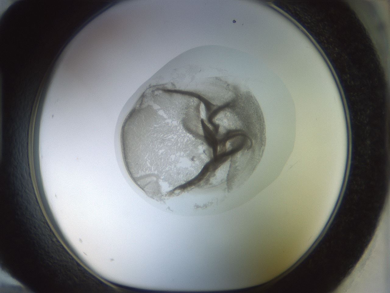 folderID15_plateID1015_batchID1886_wellNum96_profileID1_d1_r43075_ef.jpg