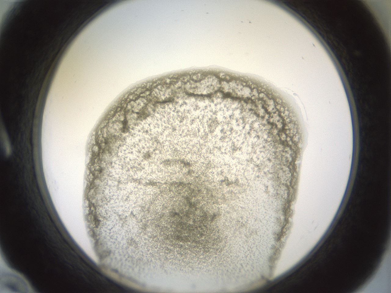 folderID15_plateID2015_batchID8963_wellNum10_profileID1_d1_r135484_ef.jpg