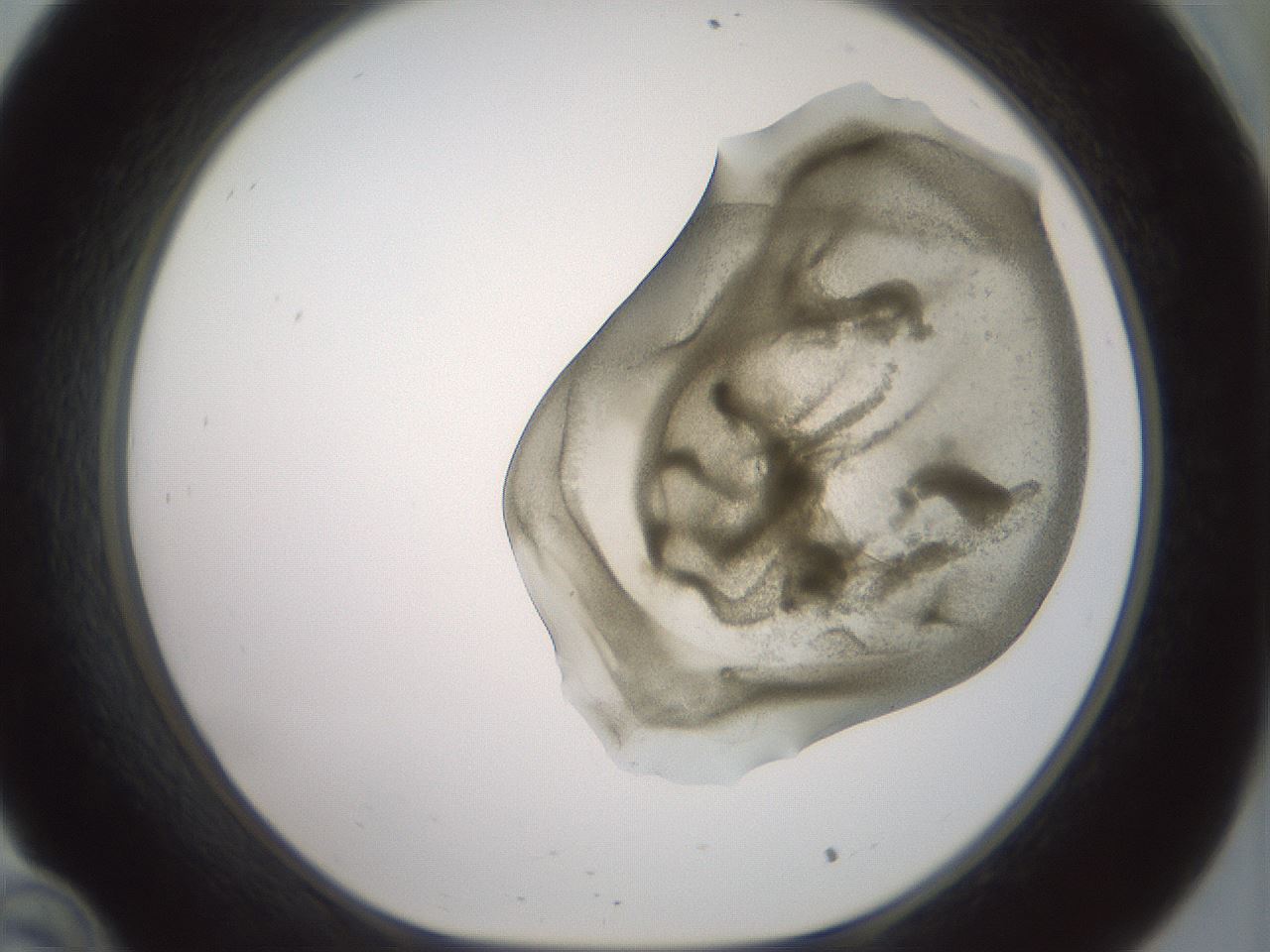 folderID15_plateID2015_batchID8963_wellNum34_profileID1_d1_r135532_ef.jpg