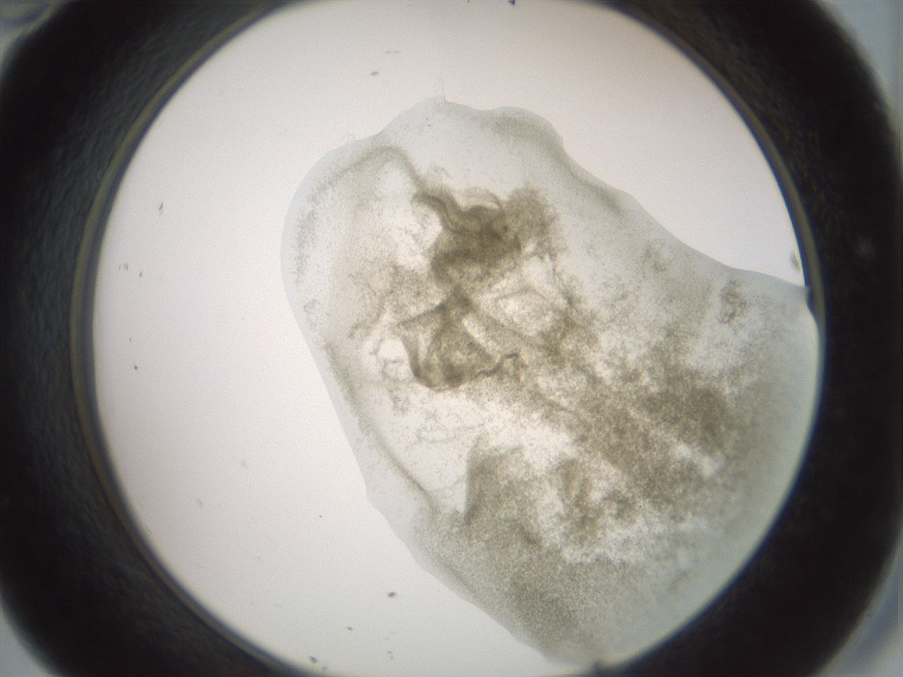 folderID15_plateID2015_batchID8963_wellNum46_profileID1_d2_r135557_ef.jpg