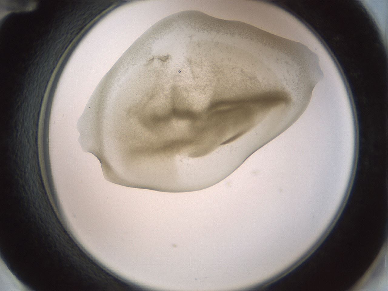 folderID15_plateID2015_batchID8963_wellNum60_profileID1_d2_r135585_ef.jpg