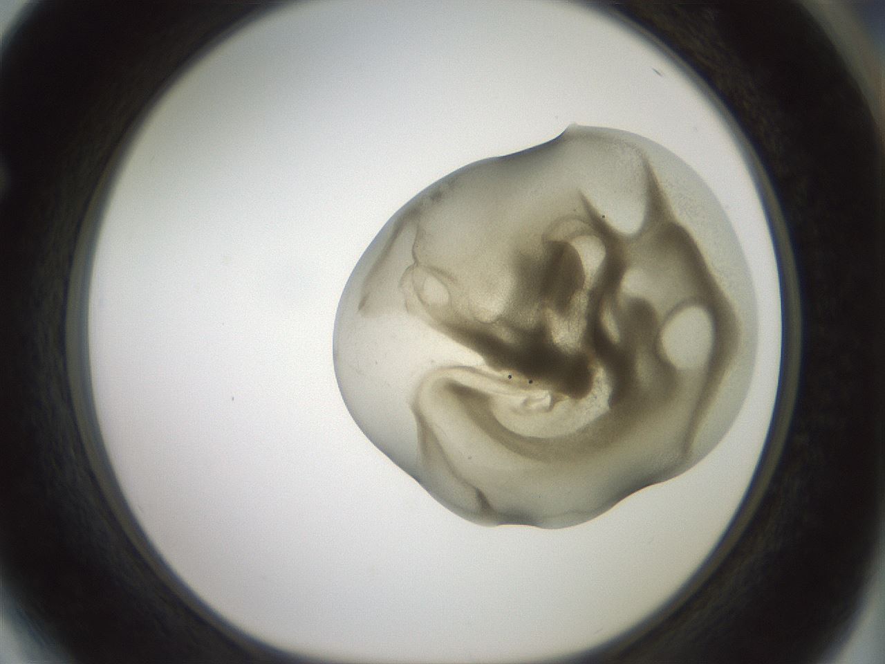 folderID15_plateID2015_batchID8963_wellNum64_profileID1_d1_r135592_ef.jpg