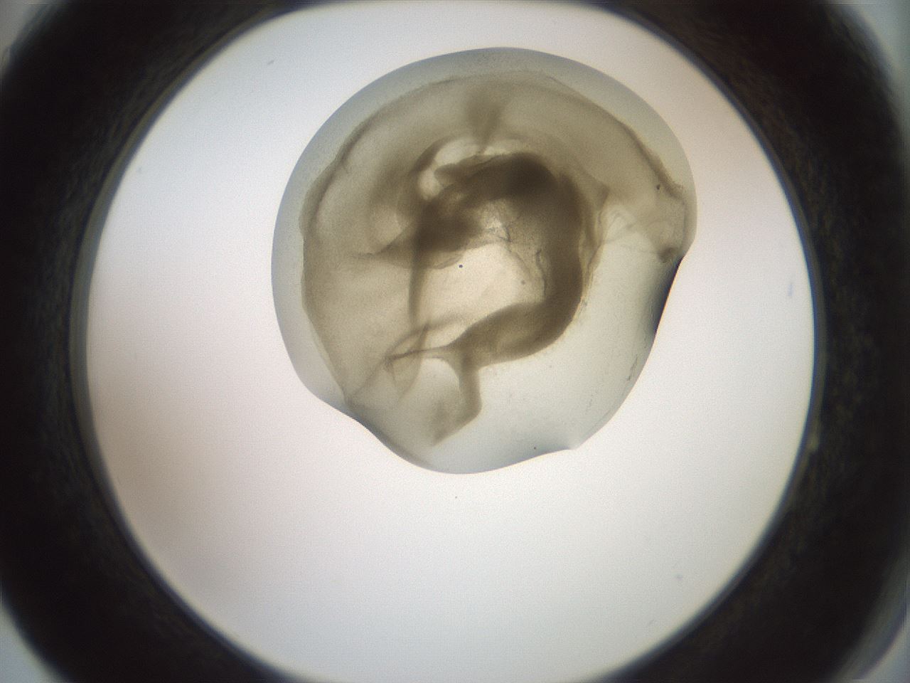 folderID15_plateID2015_batchID8963_wellNum64_profileID1_d2_r135593_ef.jpg