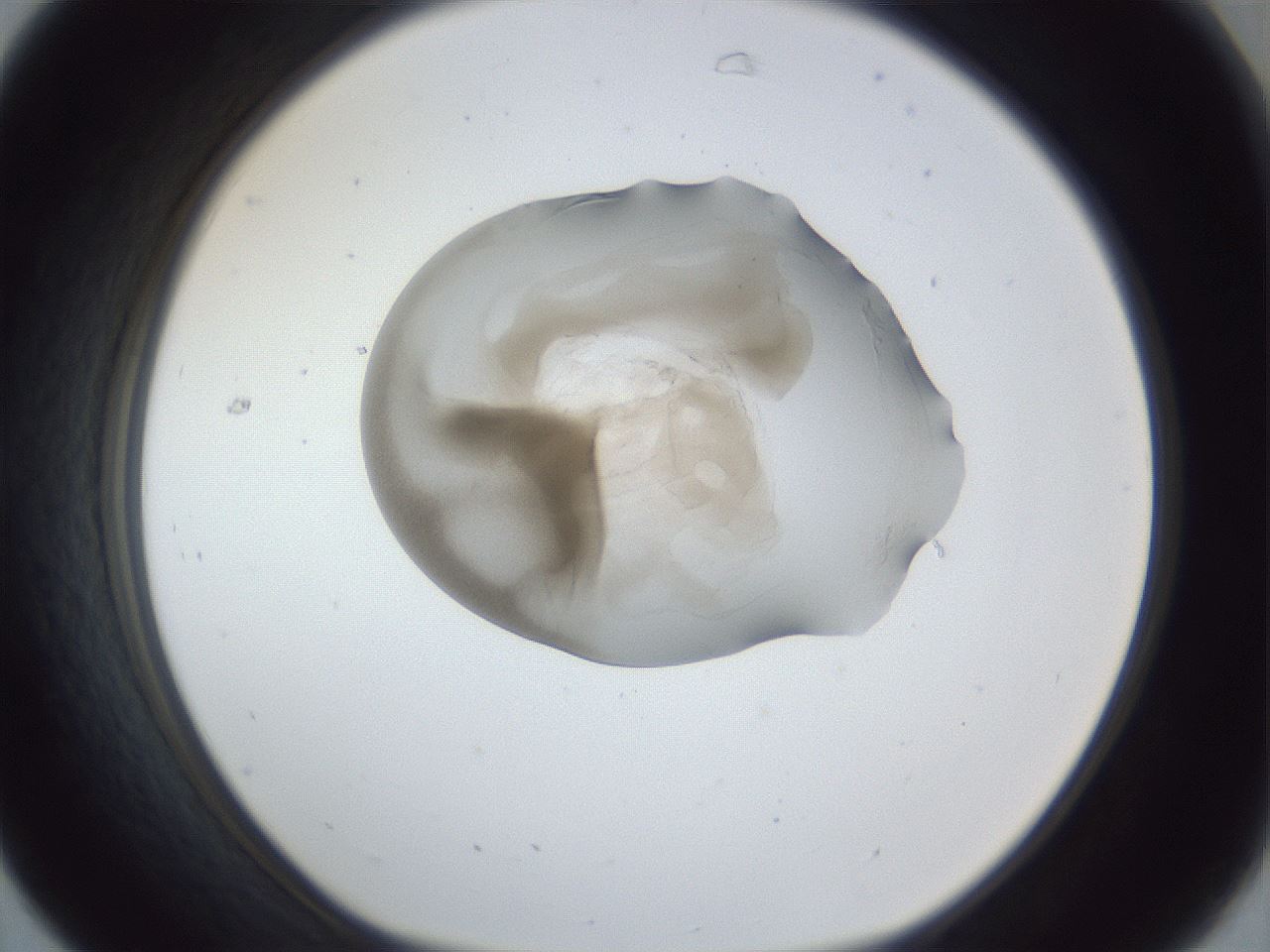 folderID163_plateID1163_batchID3206_wellNum31_profileID1_d1_r62683_ef.jpg