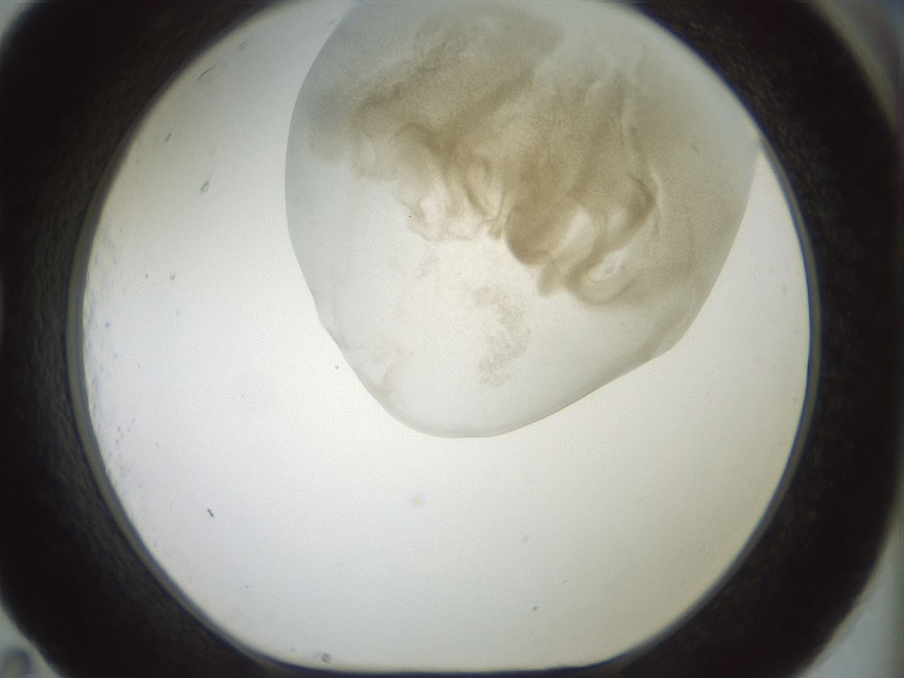 folderID15_plateID2015_batchID8963_wellNum83_profileID1_d1_r135630_ef.jpg