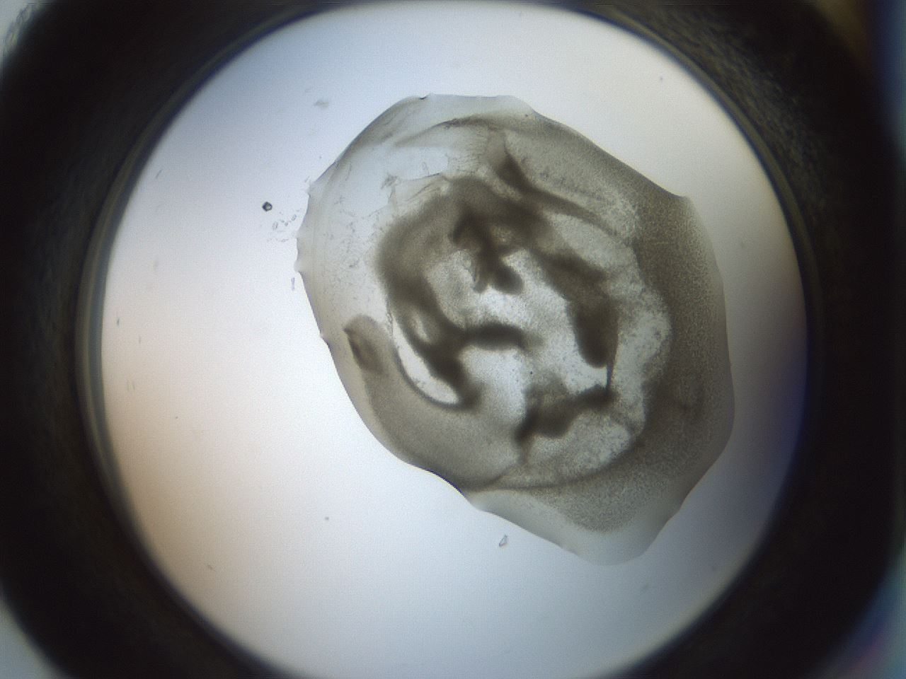folderID15_plateID2015_batchID8963_wellNum93_profileID1_d2_r135651_ef.jpg
