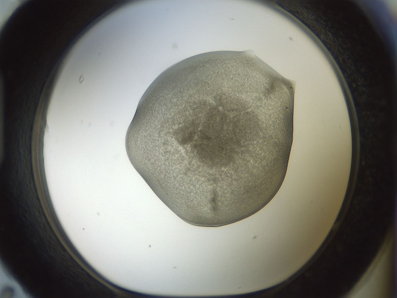 folderID15_plateID2015_batchID8963_wellNum95_profileID1_d1_r135654_ef.jpg