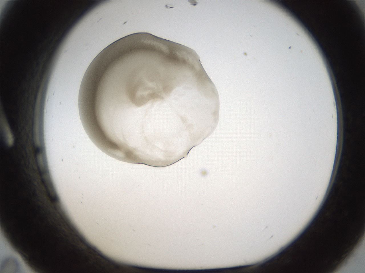 folderID160_plateID1160_batchID3204_wellNum11_profileID1_d1_r62259_ef.jpg