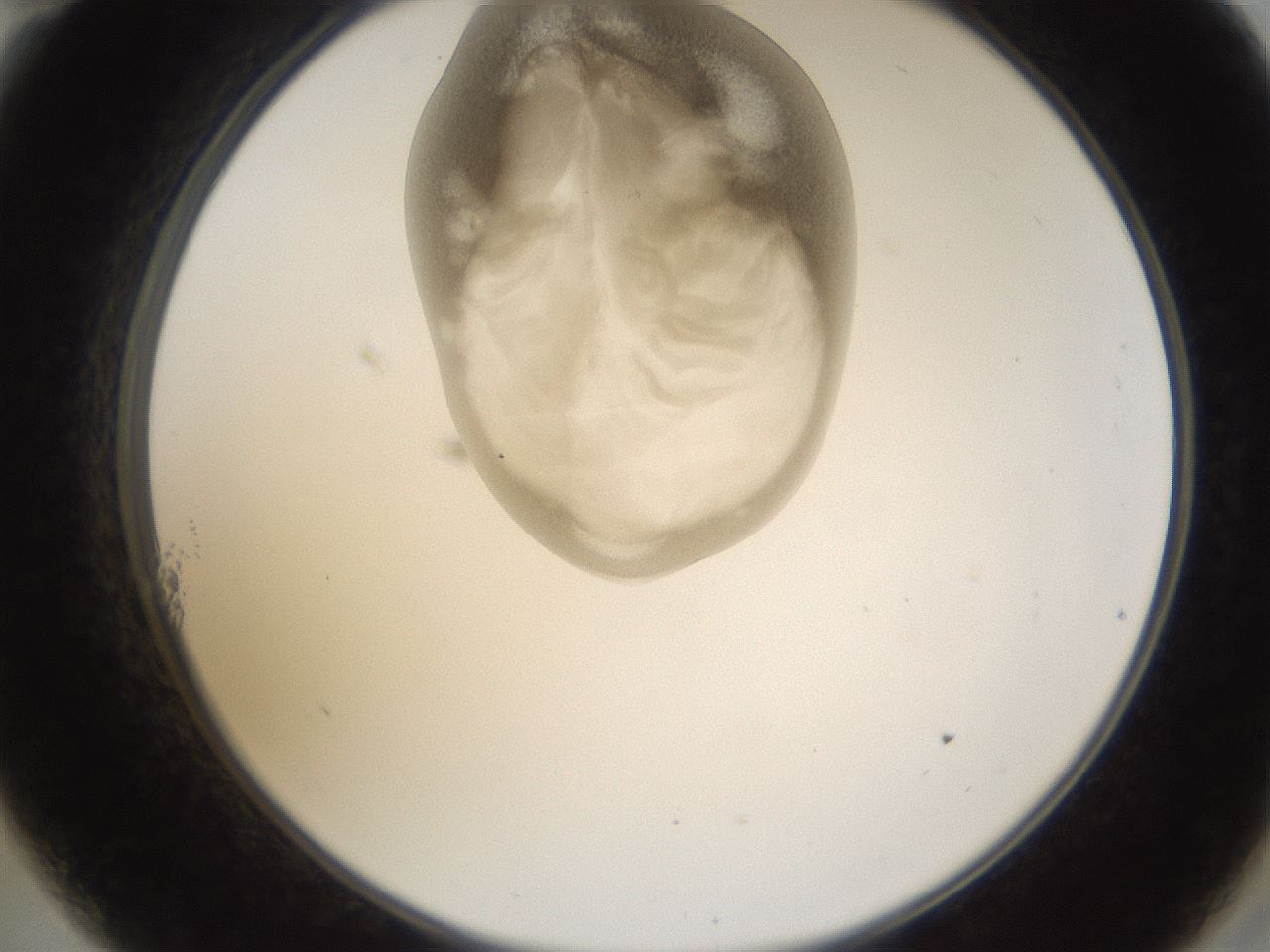 folderID160_plateID1160_batchID3204_wellNum11_profileID1_d2_r62260_ef.jpg
