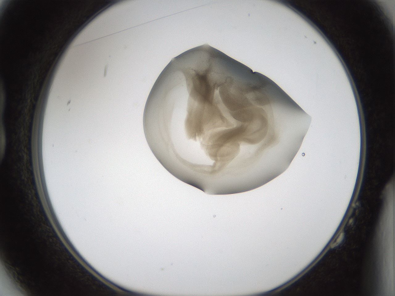 folderID160_plateID1160_batchID3204_wellNum14_profileID1_d1_r62265_ef.jpg