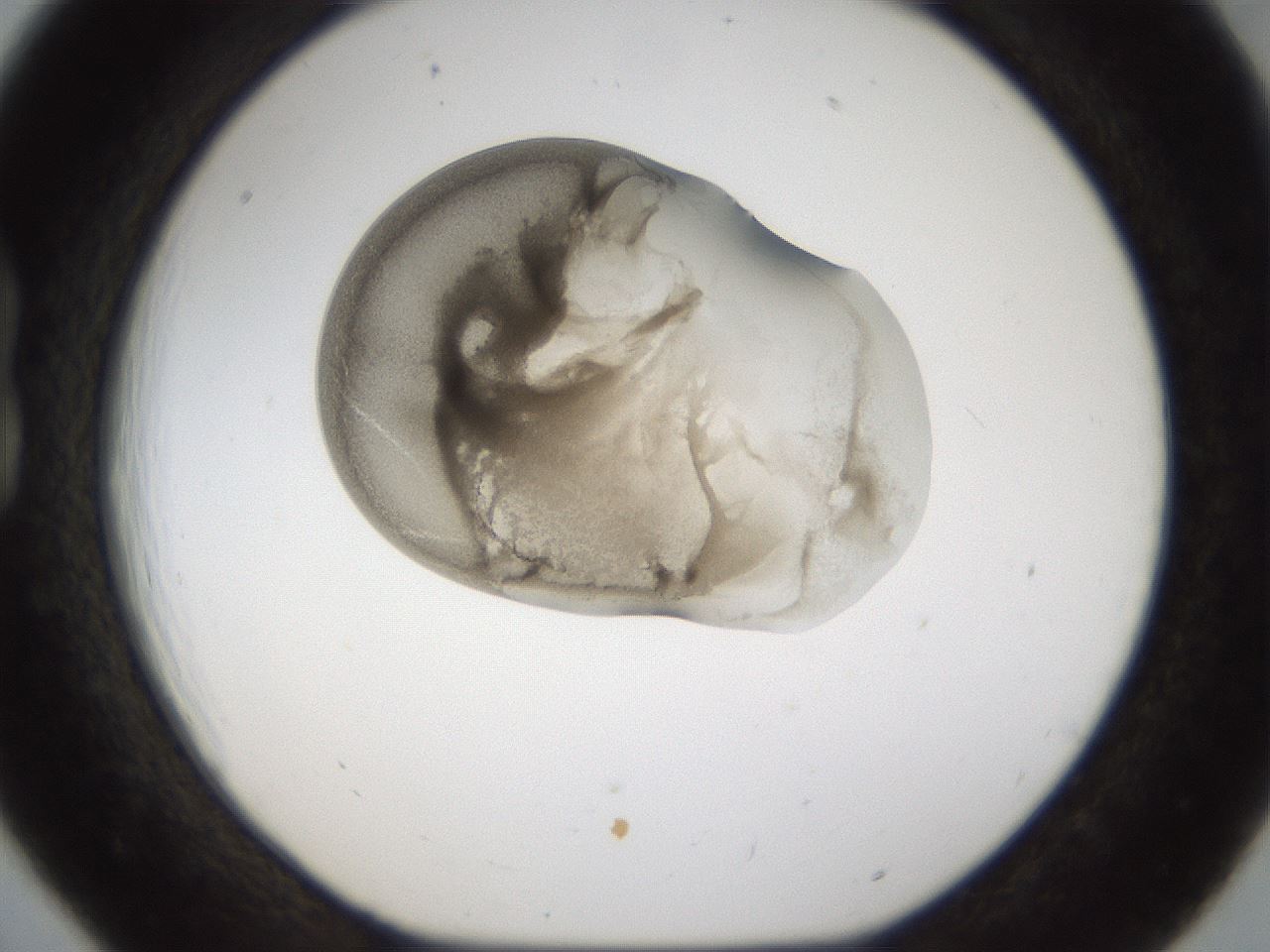folderID160_plateID1160_batchID3204_wellNum18_profileID1_d1_r62273_ef.jpg